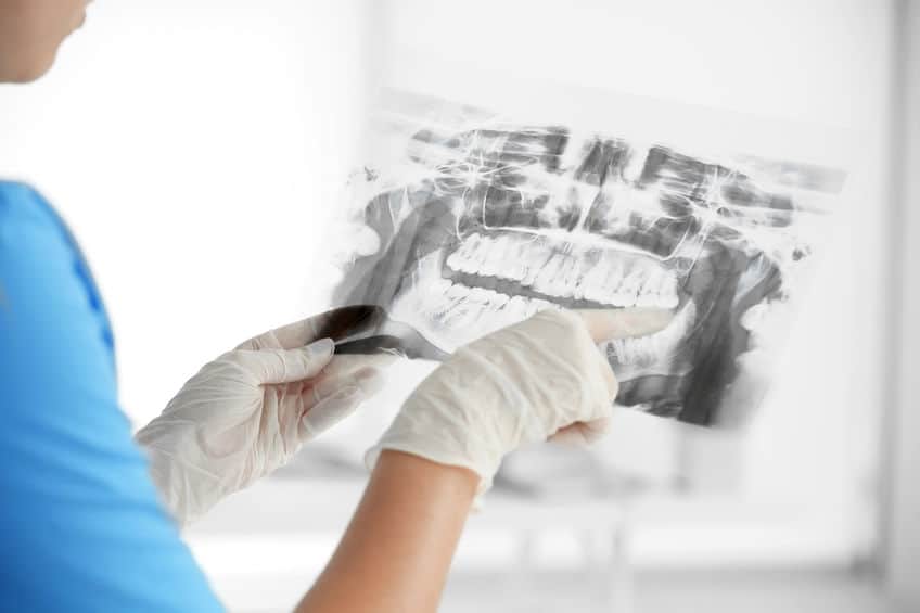 Female dentist holding a dental X-Ray bone grafting